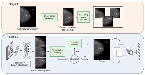 Deep Learning Based Methods for Breast Cancer Diagnosis: A .